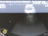 Ultraschallbilder