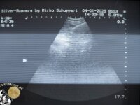 Ultraschallbilder 29er Tag